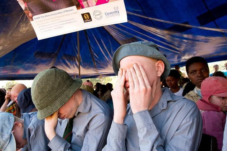 BAMBA DIOP TIRE LA SONNETTE D’ALARME